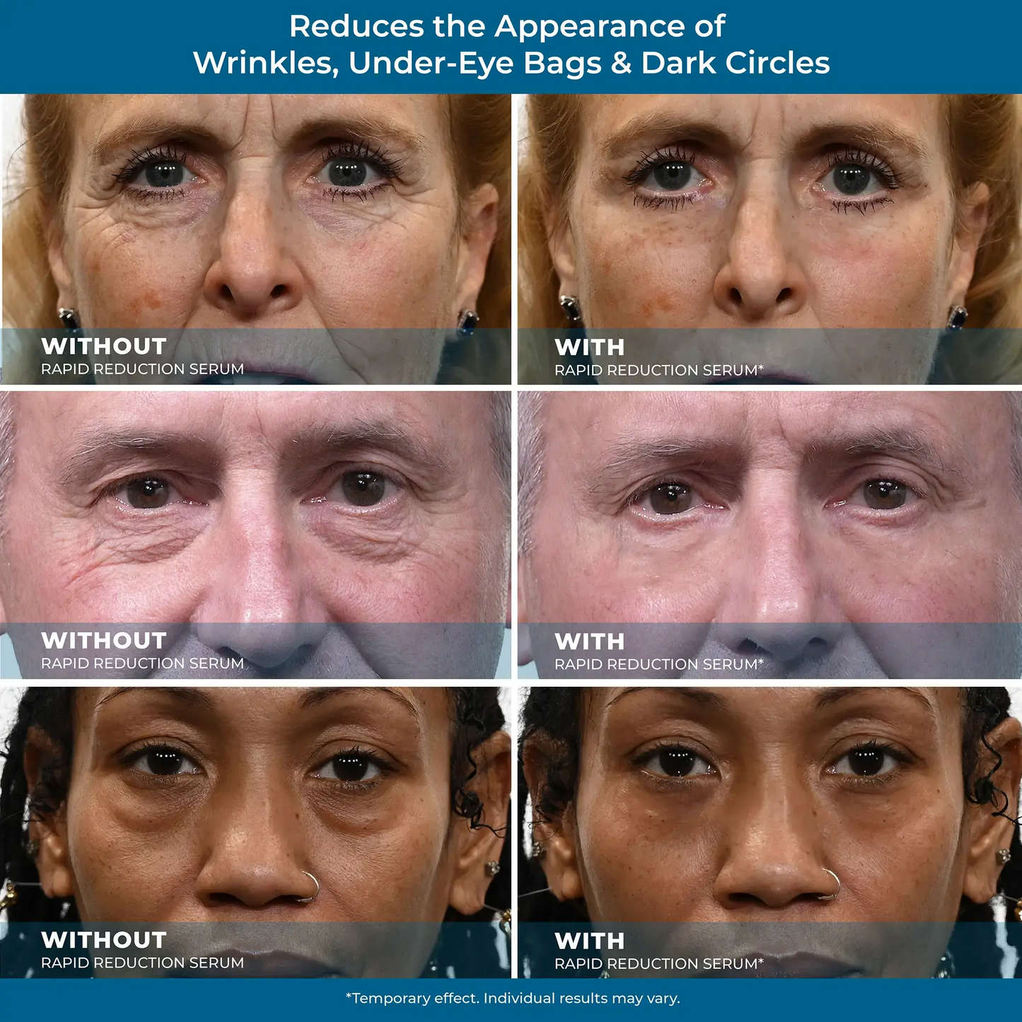 Rapid Reduction Serum – 1-Month Supply