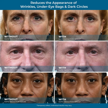 Rapid Reduction Serum – 1-Month Supply